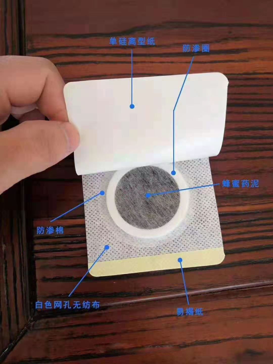 穴位壓力刺激貼。